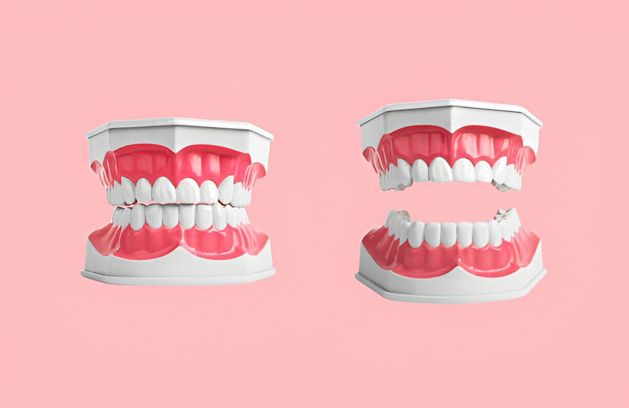 Dentures