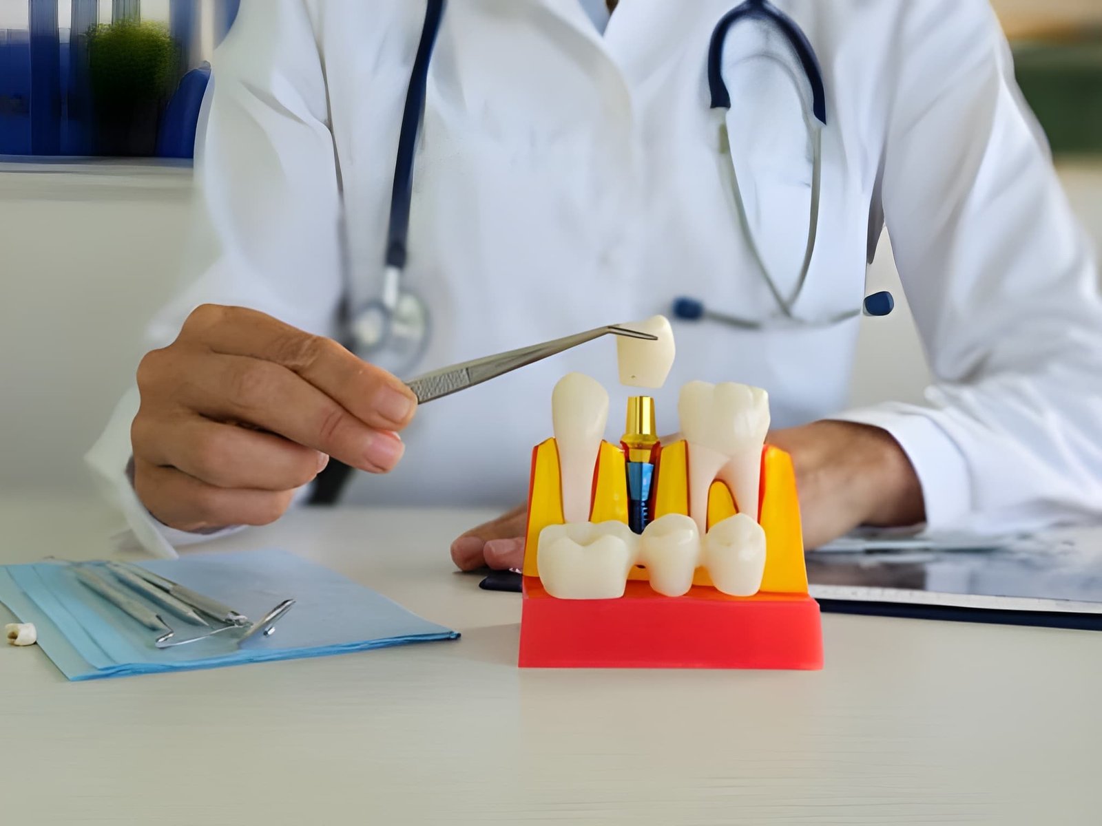 Dental implant
